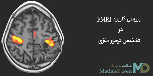 بررسی کاربرد FMRI در تشخیص تومور مغزی