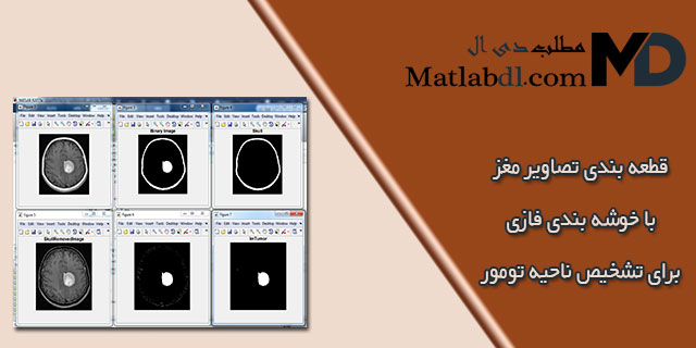 قطعه بندی تصاویر MRI مغز با خوشه بندی فازی برای تشخیص ناحیه تومور